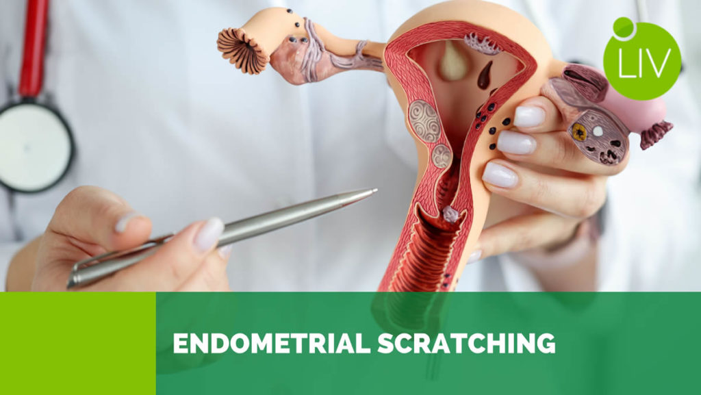 Endometrial Scratch Biopsy Mexico,