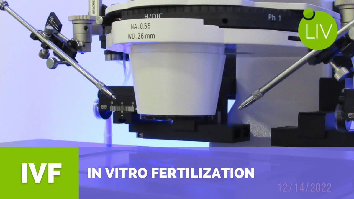 IVF Mexico Advanced Treatment, LIV Fertility Center Puerto Vallarta, In vitro Fertilization